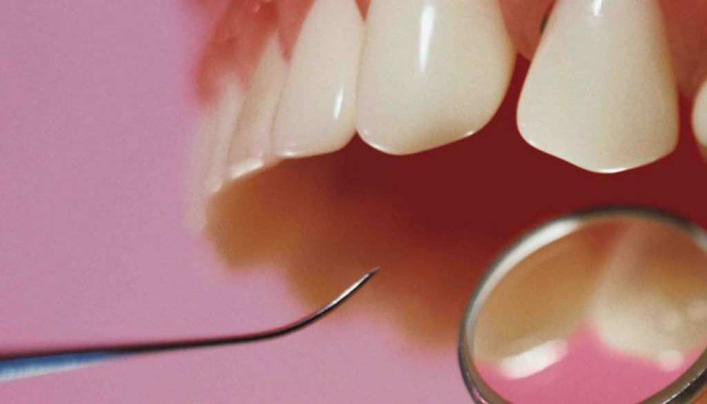 Cuidados de las resinas dentales